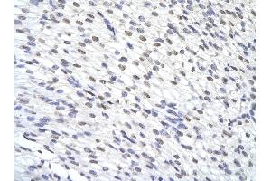 Rabbit Anti-ZFP36 antibody        Paraffin Embedded Tissue:  Human Heart cell   Cellular Data:  Epithelial cells of renal tubule  Antibody Concentration:   4. (ZFP36 anticorps  (N-Term))