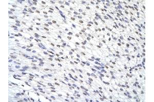 Rabbit Anti-ZFP36 antibody        Paraffin Embedded Tissue:  Human Heart cell   Cellular Data:  Epithelial cells of renal tubule  Antibody Concentration:   4. (ZFP36 anticorps  (N-Term))