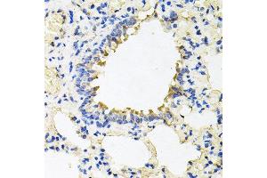 Immunohistochemistry of paraffin-embedded rat lung using CALU antibody at dilution of 1:100 (x40 lens). (CALU anticorps)