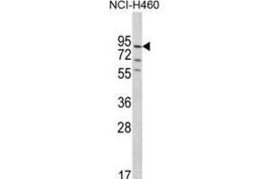 Western Blotting (WB) image for anti-Pleckstrin Homology Domain Containing, Family G (With RhoGef Domain) Member 6 (PLEKHG6) antibody (ABIN3002882) (PLEKHG6 anticorps)
