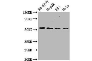 Western Blot Positive WB detected in: SH-SY5Y whole cell lysate, HepG2 whole cell lysate, 293 whole cell lysate, Hela whole cell lysate All lanes: SLC19A3 antibody at 3. (SLC19A3 anticorps  (AA 191-282))