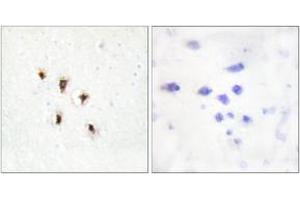 Immunohistochemistry analysis of paraffin-embedded human brain tissue, using Mevalonate Kinase Antibody.