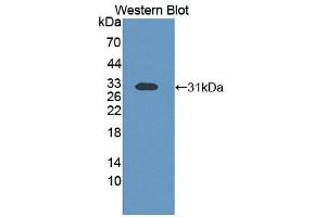 Western blot analysis of recombinant Human ETFb. (ETFB anticorps  (AA 2-255))
