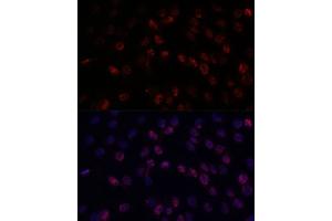 Immunofluorescence analysis of C6 cells using DDX24 antibody (ABIN7266691) at dilution of 1:100. (DDX24 anticorps  (AA 510-859))