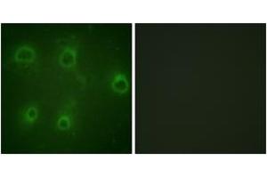 Immunofluorescence analysis of COS7 cells, using IL-8R beta/CDw128 beta (Phospho-Ser347) Antibody. (CXCR2 anticorps  (pSer347))