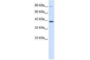 WB Suggested Anti-CCDC16 Antibody Titration:  1.