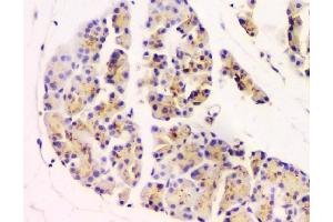IHC analysis of GM130 using anti-GM130 antibody (ABIN6719433).