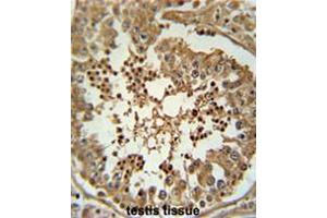 anti-Chromosome 3 Open Reading Frame 58 (C3ORF58) (AA 166-196), (Middle Region) antibody