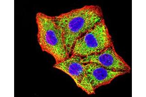 Immunocytochemistry (ICC) image for anti-BCL2/adenovirus E1B 19kDa Interacting Protein 3 (BNIP3) (AA 50-155) antibody (ABIN5858883) (BNIP3 anticorps  (AA 50-155))