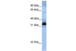 WB Suggested Anti-SFRS2B  Antibody Titration: 0. (SFRS2B anticorps  (Middle Region))
