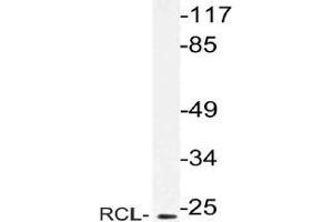 Western blot (WB) analysis of RCL antibody in extracts from Jurkat cells. (RCL anticorps)