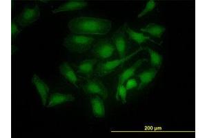 Image no. 4 for anti-PDZ Binding Kinase (PBK) (AA 1-110) antibody (ABIN599274) (PBK anticorps  (AA 1-110))