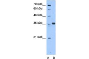 Western Blotting (WB) image for anti-Aminoadipate-Semialdehyde Dehydrogenase-phosphopantetheinyl Transferase (AASDHPPT) antibody (ABIN2463215) (AASDHPPT anticorps)