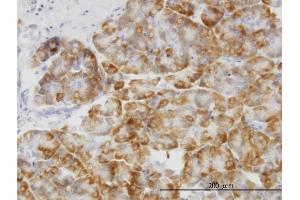 Immunoperoxidase of monoclonal antibody to MAPK14 on formalin-fixed paraffin-embedded human pancreas.