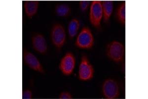 Image no. 2 for anti-Ribosomal Protein S6 (RPS6) (AA 233-237) antibody (ABIN197470) (RPS6 anticorps  (AA 233-237))