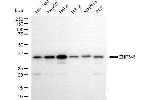 anti-Zinc Finger Protein 346 (ZNF346) antibody