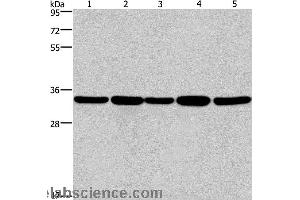 Western blot analysis of LoVo and A549 cell, human hepatocellular carcinoma tissue, Jurkat and Hela cell  , using E2F6 Polyclonal Antibody at dilution of 1:650