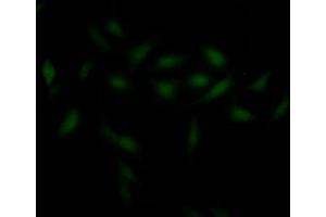 Immunofluorescence staining of Hela Cells with ABIN7127424 at 1:50, counter-stained with DAPI.