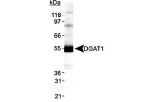 Western blot analysis of DGAT1 in HepG2 lysate using DGAT1 polyclonal antibody . (DGAT1 anticorps  (AA 200-300))
