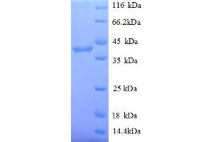 SDS-PAGE (SDS) image for Poly (ADP-Ribose) Polymerase 1 (PARP1) (AA 2-331), (partial) protein (His tag) (ABIN5710069) (PARP1 Protein (AA 2-331, partial) (His tag))