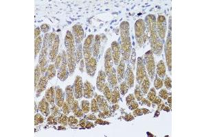 Immunohistochemistry of paraffin-embedded mouse stomach using TrkA Antibody (ABIN3022908, ABIN3022909, ABIN3022910 and ABIN6219291) at dilution of 1:100 (40x lens).