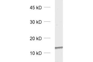 dilution: 1 : 5000, sample: rat brain homogenate (PVALB anticorps)