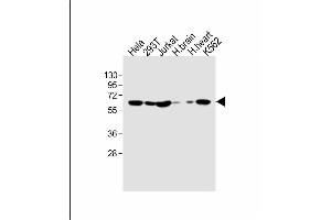 All lanes : Anti-IFNAR1 Antibody (Center) at 1:1000 dilution Lane 1: Hela whole cell lysate Lane 2: 293T whole cell lysate Lane 3: Jurkat whole cell lysate Lane 4: human brain lysate Lane 5: human heart lysate Lane 6: K562 whole cell lysate Lysates/proteins at 20 μg per lane. (IFNAR1 anticorps  (AA 162-188))