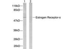 Western Blotting (WB) image for anti-Estrogen Receptor 1 (ESR1) (AA 81-130) antibody (ABIN2888985) (Estrogen Receptor alpha anticorps  (AA 81-130))