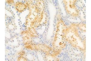 ABIN7097106 and ABIN7101173 at 1/100 staining human normal kidney tissue by IHC-P. (OSCAR anticorps)