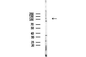 anti-Transmembrane Protease, serine 15 (TMPRSS15) (Internal Region) antibody