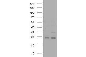 Image no. 2 for anti-RAB21, Member RAS Oncogene Family (RAB21) antibody (ABIN1500546) (RAB21 anticorps)
