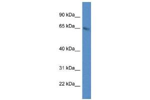 WB Suggested Anti-METTL3 AntibodyTitration: 1.