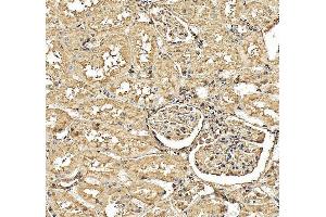 anti-Cystatin C (CST3) (AA 31-146) antibody