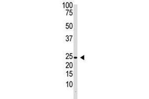 Image no. 1 for anti-Interleukin 29 (IL29) (Center) antibody (ABIN357175)