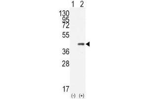 Western blot analysis of CDX2 antibody and 293 cell lysate (2 ug/lane) either nontransfected (Lane 1) or transiently transfected with the human gene (2). (CDX2 anticorps  (AA 1-30))