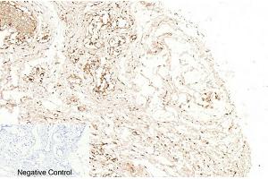 Immunohistochemical analysis of paraffin-embedded human breast tissue. (Caspase 1 anticorps  (Cleaved-Asp210))