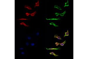 ABIN6262736 and ABIN6277134 staining Hela cells by IF/ICC. (KBTBD3 anticorps  (C-Term))