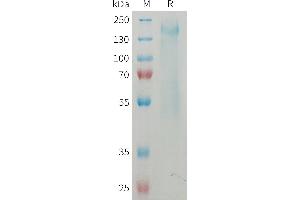 Mouse CD45 Protein, His Tag on SDS-PAGE under reducing condition.