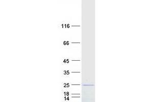 Validation with Western Blot