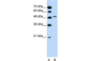 Western Blotting (WB) image for anti-Solute Carrier Family 10 (Sodium/bile Acid Cotransporter Family), Member 5 (SLC10A5) antibody (ABIN2462731) (SLC10A5 anticorps)
