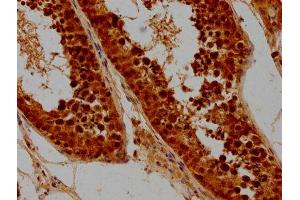 IHC image of ABIN7171134 diluted at 1:300 and staining in paraffin-embedded human testis tissue performed on a Leica BondTM system.