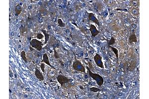 ABIN6259940 and ABIN6268705 at 1/100 staining Rat brain tissue by IHC-P. (Annexin A3 anticorps  (N-Term))