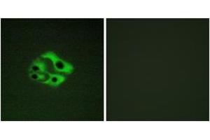 Immunofluorescence analysis of HeLa cells, using BAD (Phospho-Ser134) Antibody. (BAD anticorps  (pSer134))