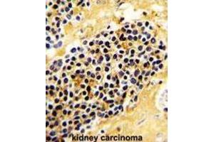Immunohistochemistry (IHC) image for anti-Killer Cell Lectin-Like Receptor Subfamily C, Member 1 (KLRC1) antibody (ABIN2936813)