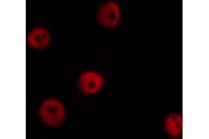 ABIN6266456 staining HuvEc by IF/ICC. (HNRNPD/AUF1 anticorps  (pSer83))