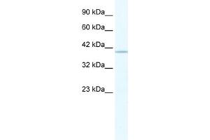WB Suggested Anti-TRIM68 Antibody Titration:  2. (TRIM68 anticorps  (C-Term))