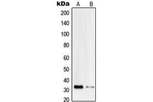 Western blot analysis of PI-TP beta expression in Jurkat (A), HeLa (B) whole cell lysates. (PITPNB anticorps  (Center))