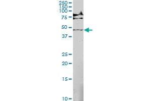 MAP2K5 monoclonal antibody (M01), clone M1-E6.