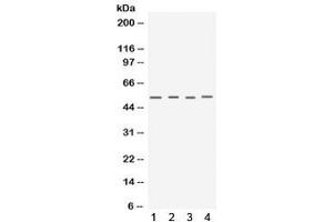 Western blot testing of 1) mouse testis, 2) mouse skeletal muscle, 3) human MCF7 and 4) human A549 lysate with Keratocan antibody. (KERA anticorps)