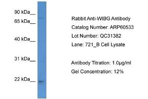 WB Suggested Anti-WIBG  Antibody Titration: 0. (PYM anticorps  (C-Term))